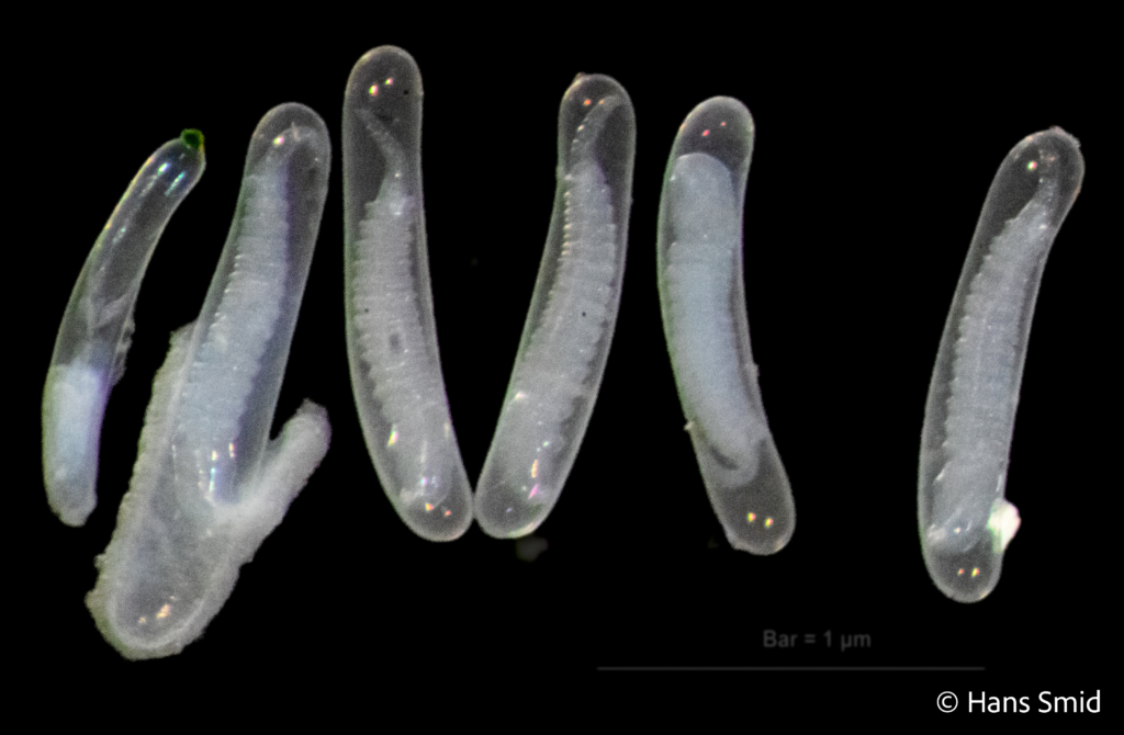 Hyposoter ebeninus parasitoid wasp  eggs dissected 001