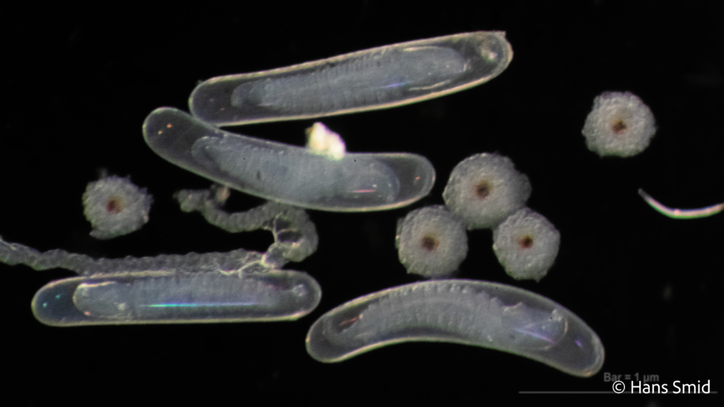 Hyposoter ebeninus parasitoid wasp  eggs dissected 002