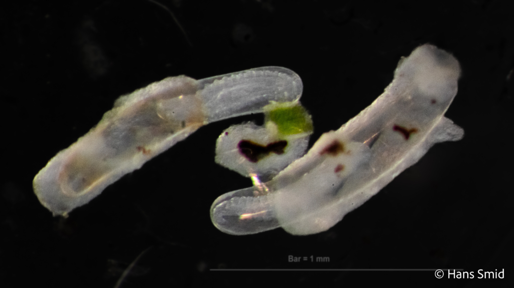 Hyposoter ebeninus parasitoid wasp  eggs dissected 003