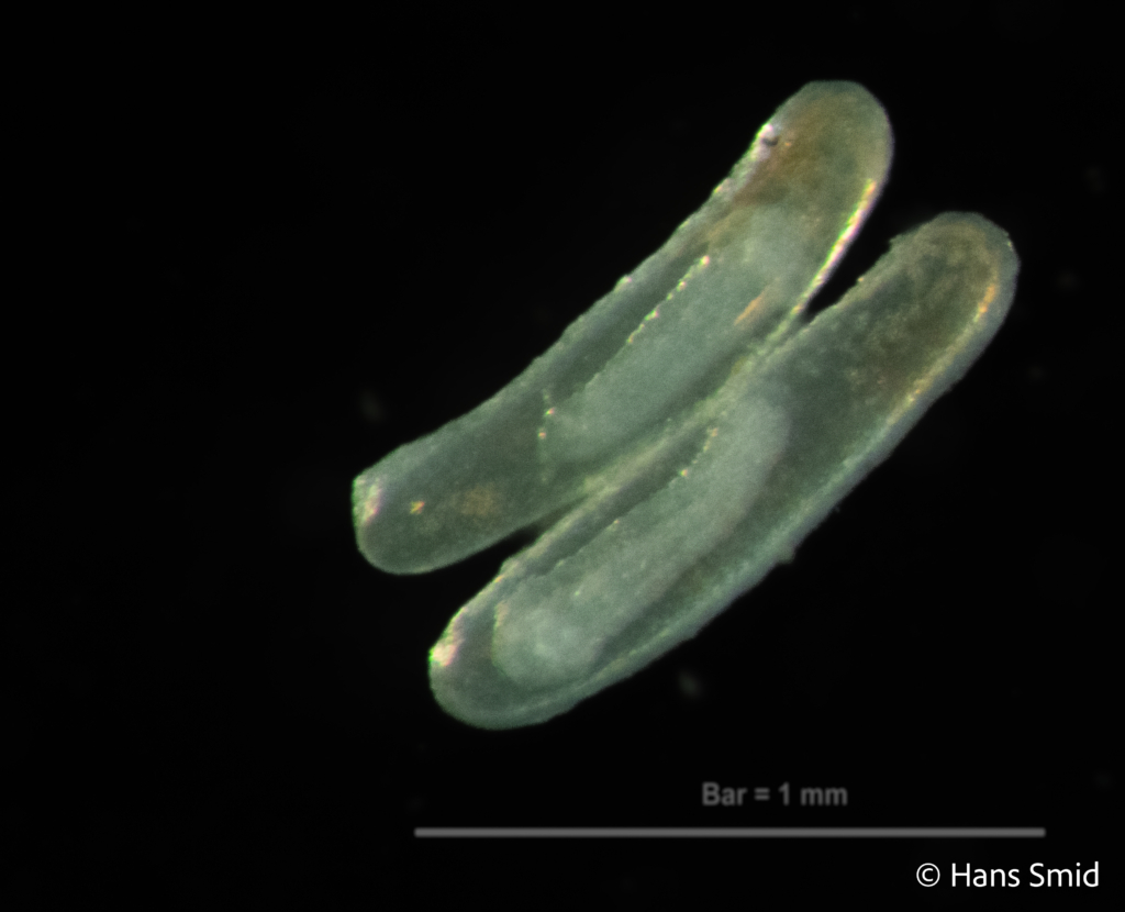 Hyposoter ebeninus parasitoid wasp  eggs dissected 004