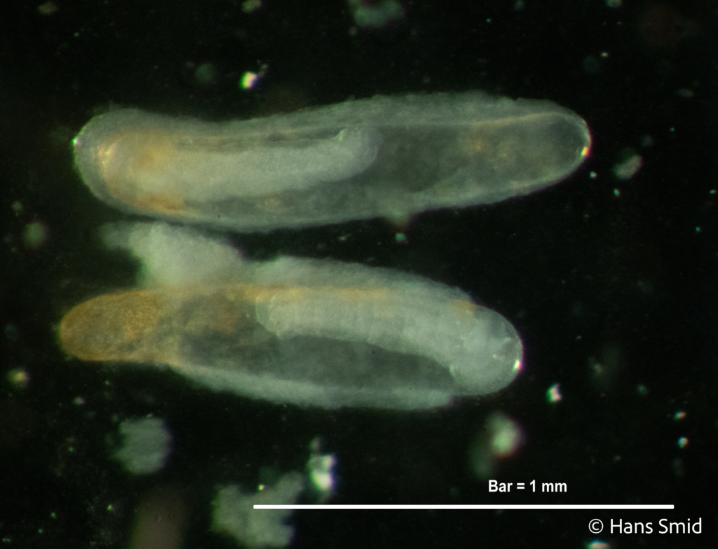 Hyposoter ebeninus parasitoid wasp  eggs dissected 005
