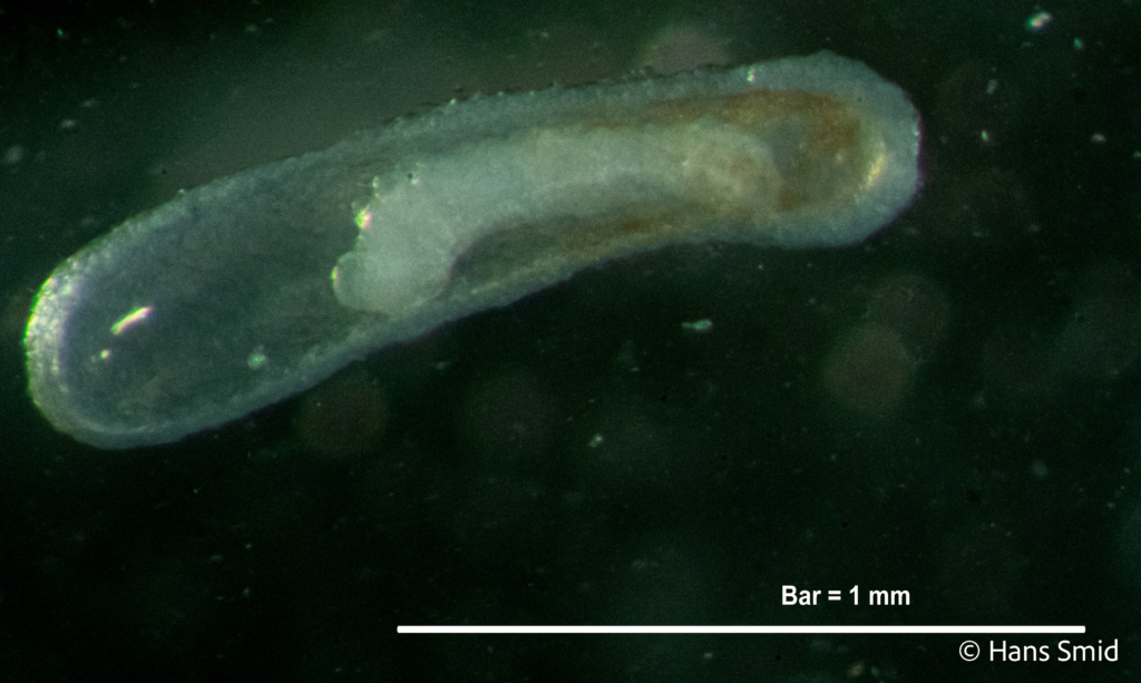 Hyposoter ebeninus parasitoid wasp  eggs dissected 009